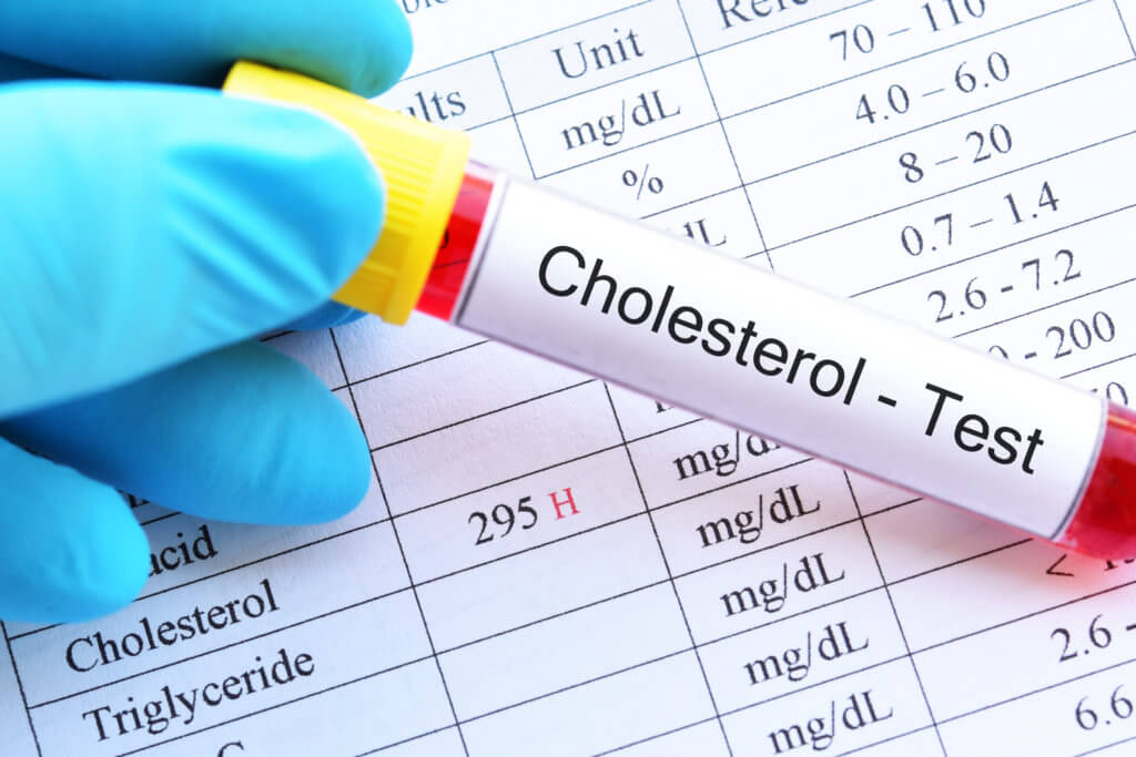 Prueba de colesterol: los resultados muestran colesterol alto