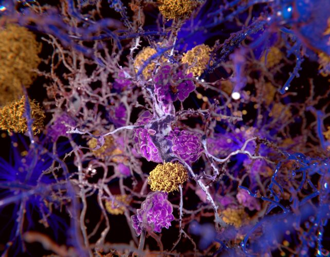 Se forman células amarillas entre las neuronas moradas