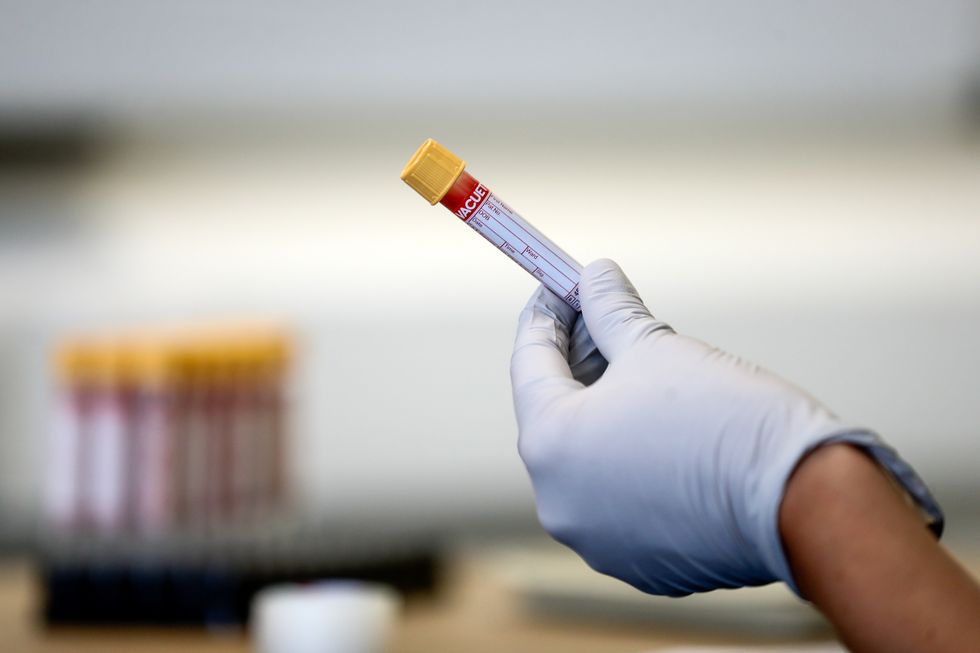 El doctor realiza el análisis de sangre