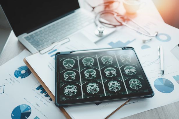 La tableta está cerca de una tableta digital con cerebro de rayos X en la pantalla.