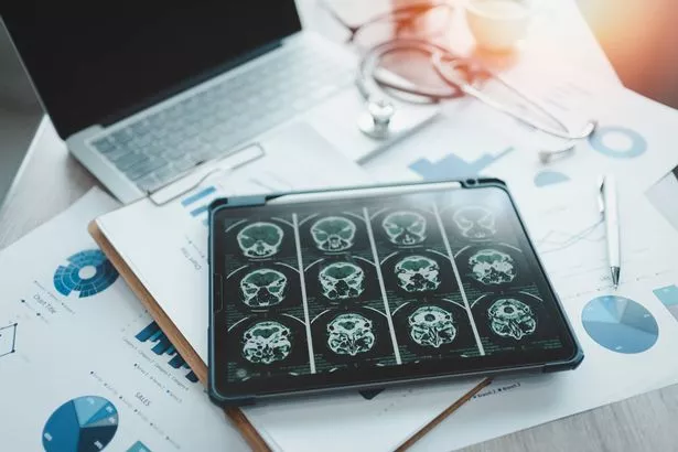 Para cerrar la zanja digital y el cerebro es el cerebro de rayos X en la pantalla
