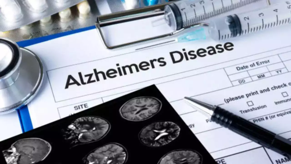 Alzheimer's