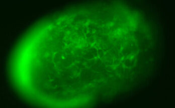 A live image of vascularized neuroimmune organoids. The green signal highlights the vascular structures within the mini brain.