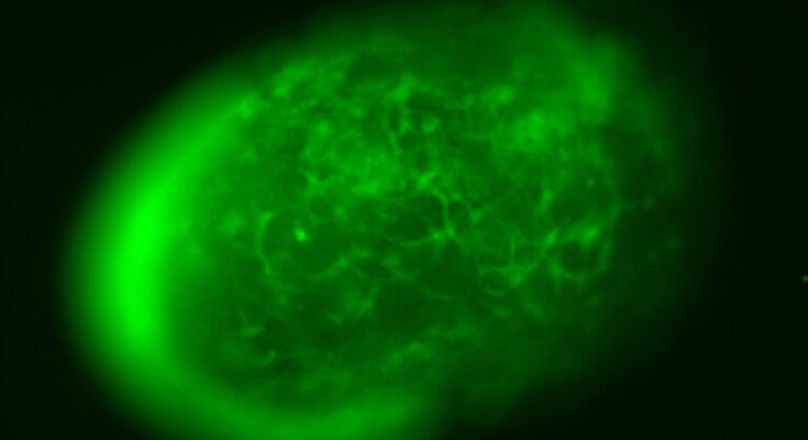 A live image of vascularized neuroimmune organoids. The green signal highlights the vascular structures within the mini brain.