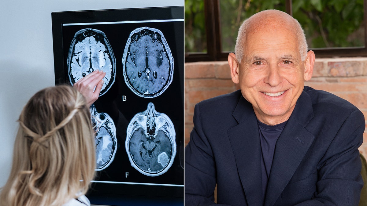 Un médico para ver la foto del cerebro y el Dr. Daniel Amen Headhot
