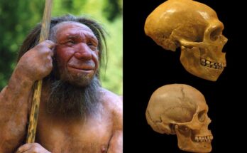 Neanderthal genes linked to rare brain-skull disorder, study finds