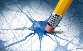 Alzheimers Dementia Brain Disease Concept
