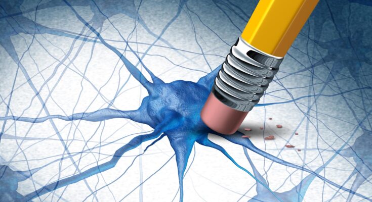 Alzheimers Dementia Brain Disease Concept