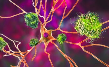 Study: Oral administration of arginine suppresses Aβ pathology in animal models of Alzheimer