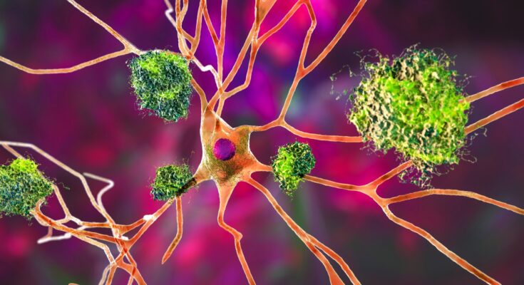 Study: Oral administration of arginine suppresses Aβ pathology in animal models of Alzheimer