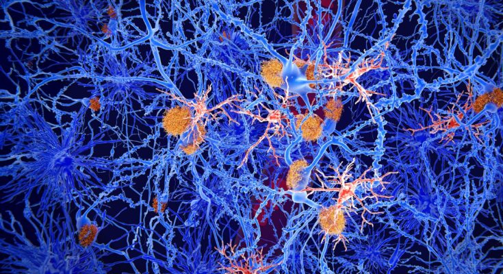 Microglia Cells Brain Neuroscience Alzheimer&rsquo;s Disease