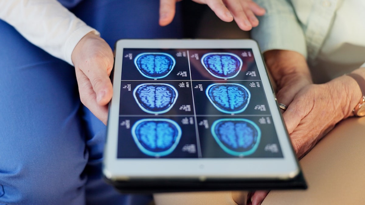 Exploración cerebral del médico y del paciente