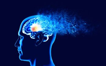 Memory lapses, forgetting things, degenerative disease. Brain problems. Parkinson and alzheimer desease. Mental health. Stroke, synapses and neurnons interaction. Face side view. 3d rendering