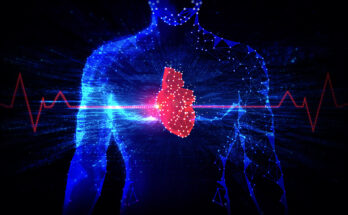 Hormone Therapy Does Not Increase Cardiovascular Disease Risk in Younger Postmenopausal Women