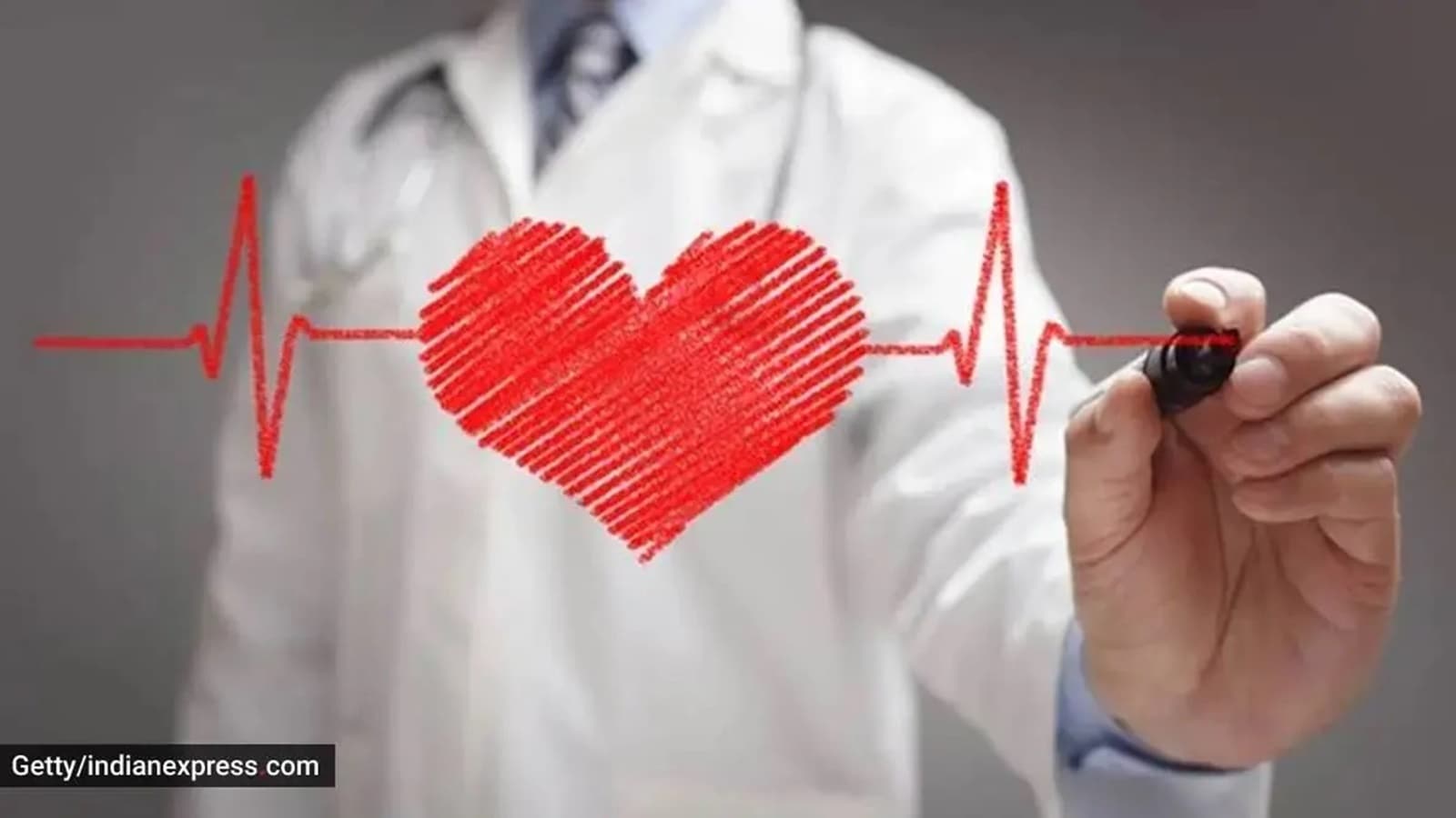 infarto de miocardio