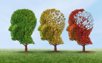 Dementia Alzheimer