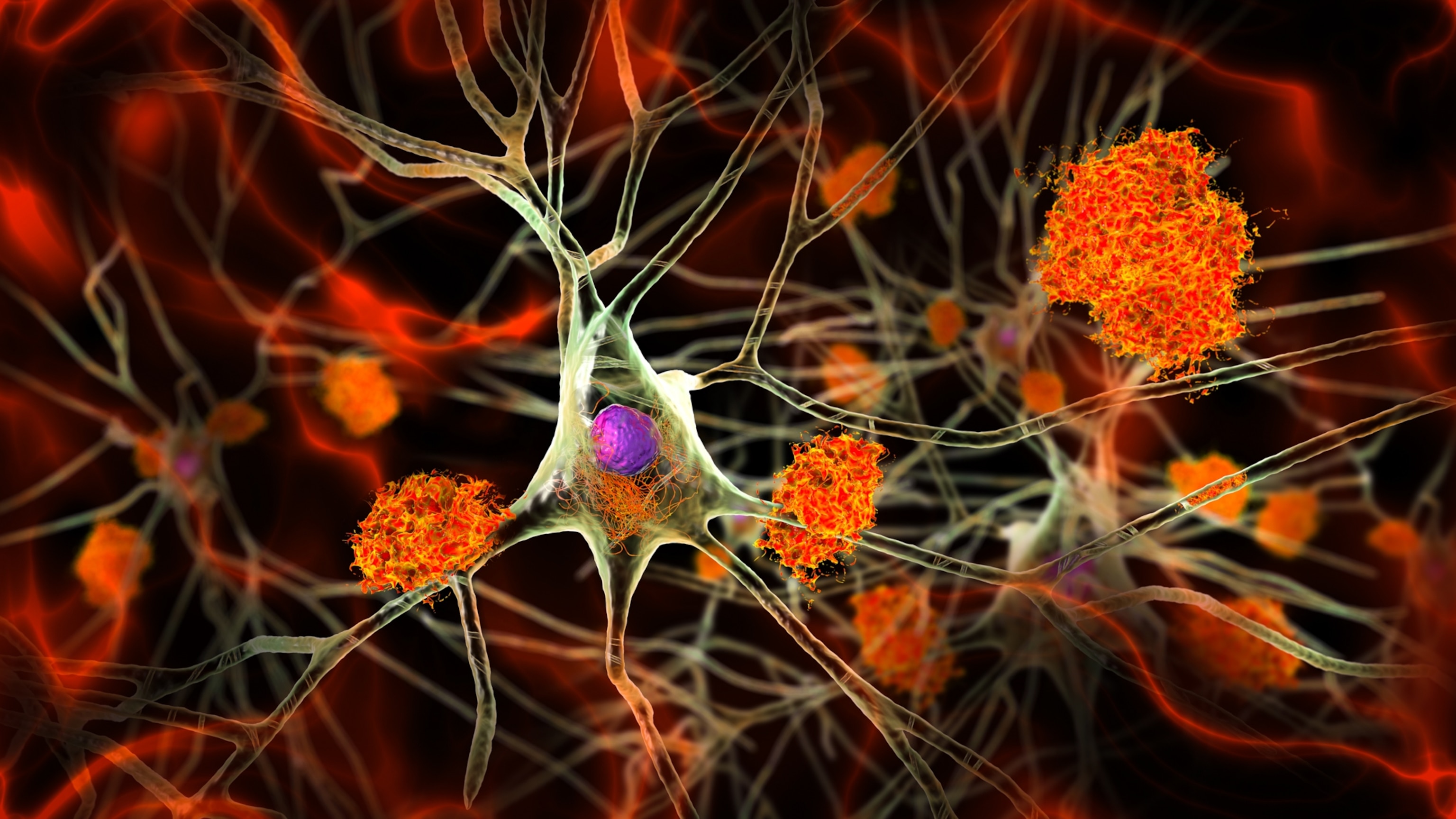 Ilustración de neuronas con bandas de placa de color naranja brillante.