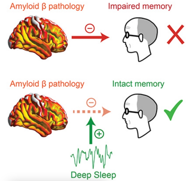 Simulación cerebral 