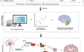 Study: Neuronal PPP2R5C in plasma is a potential biomarker for early diagnosis of Alzheimer’s disease