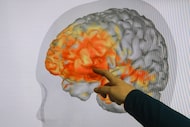 Elizabeth Davenport, profesora asistente de Radiología en UT Southwestern, señala...