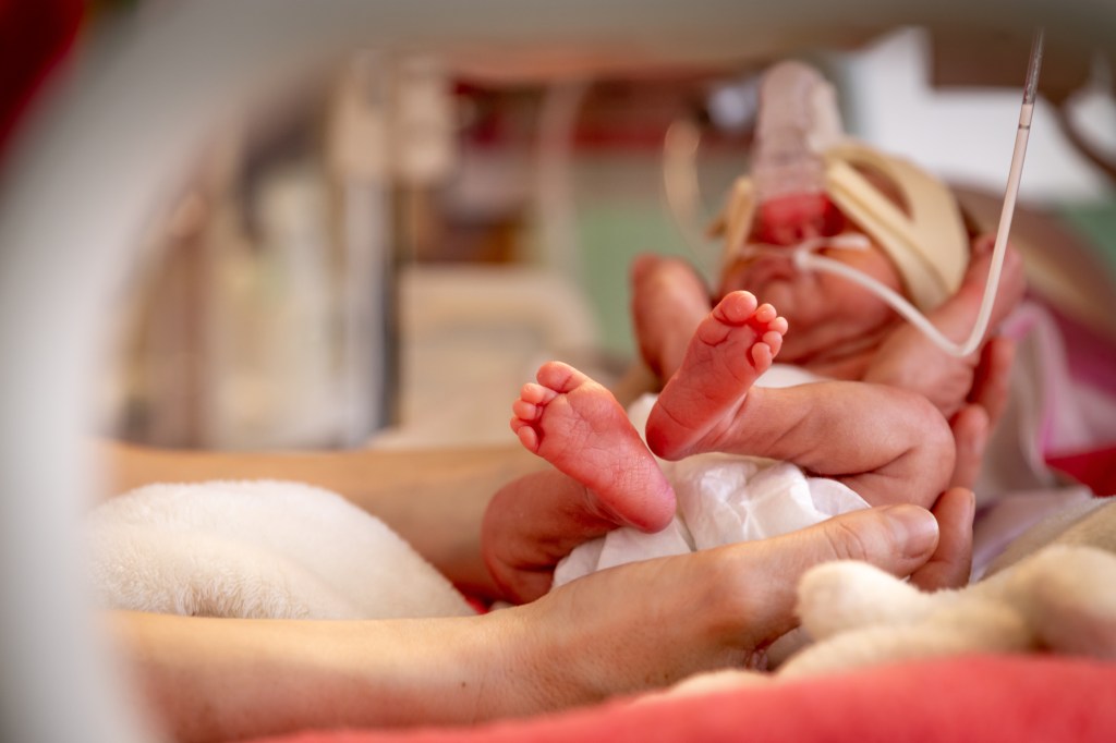 Un bebé prematuro está encerrado en una incubadora en la UCI.