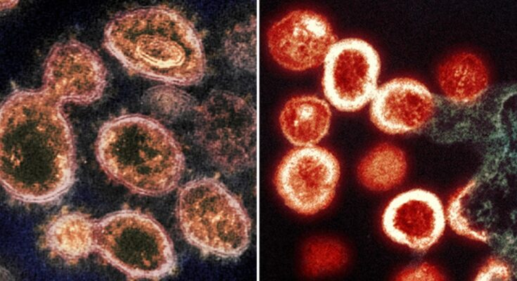 Virus covid-19 y virus VIH